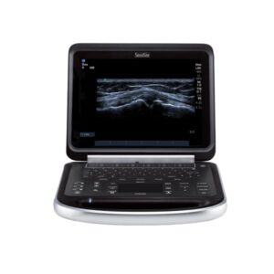 Edge II Portable Ultrasound System at AXIS Medical Solutions